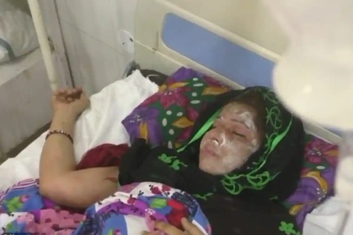 Suami Tega Siram Tubuh Istri Pakai Air Keras Gara-gara Tak Bisa Melahirkan Anak Laki-laki