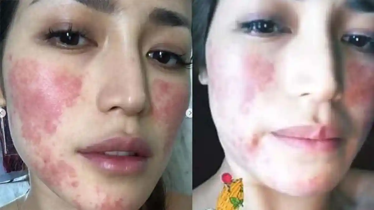 Jessica Iskandar Sudah Beri Peringatan ke Dokter, Wajahnya Malah Jadi Mengerikan