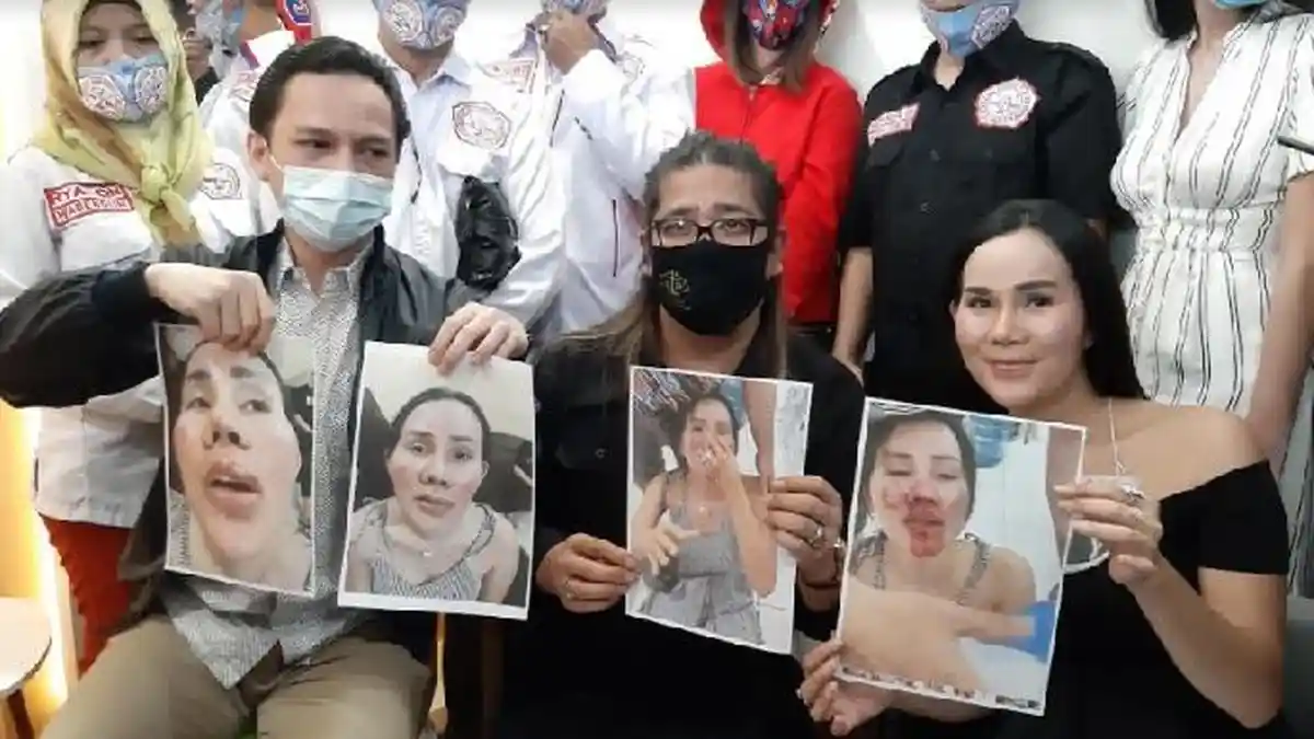 Isa Zega Bantah Soal Settingan Usai Tuding Nikita Mirzani Dalang di Balik Pemukulan Dirinya