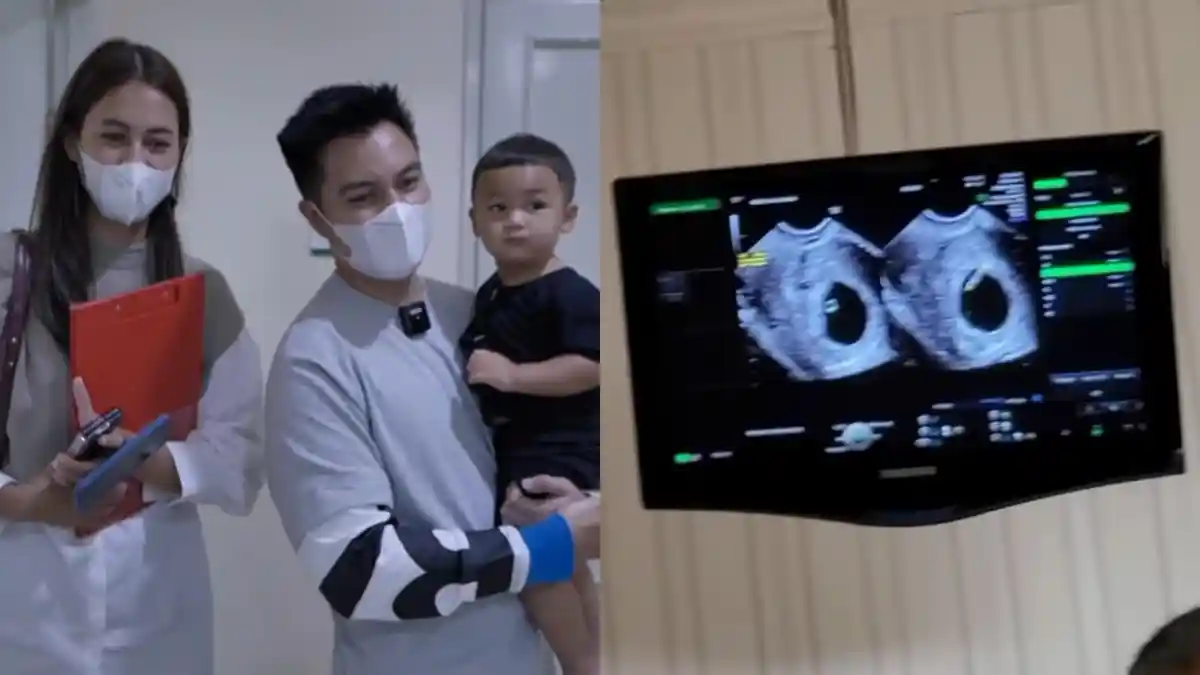 Fakta Didapat Baim Wong Dari Dokter Kandungan, Kondisi Janin di Perut Paula Verhoeven