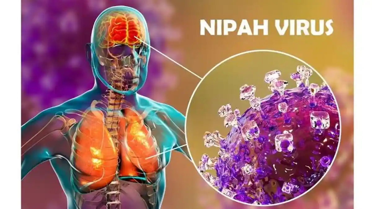 Belum Ada obatnya, Ini Daftar 9 Gejala Jika Seseorang Terjangkit Virus Nipah