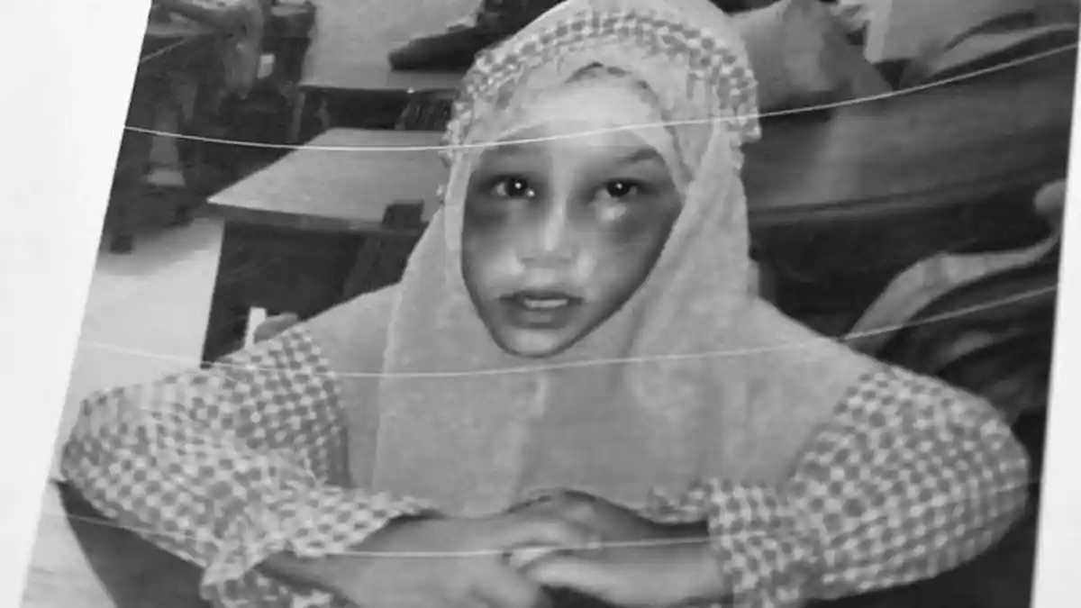 Alifa Bocah Berusia 6 Tahun ini Jadi Korban Penganiyaan Bibinya