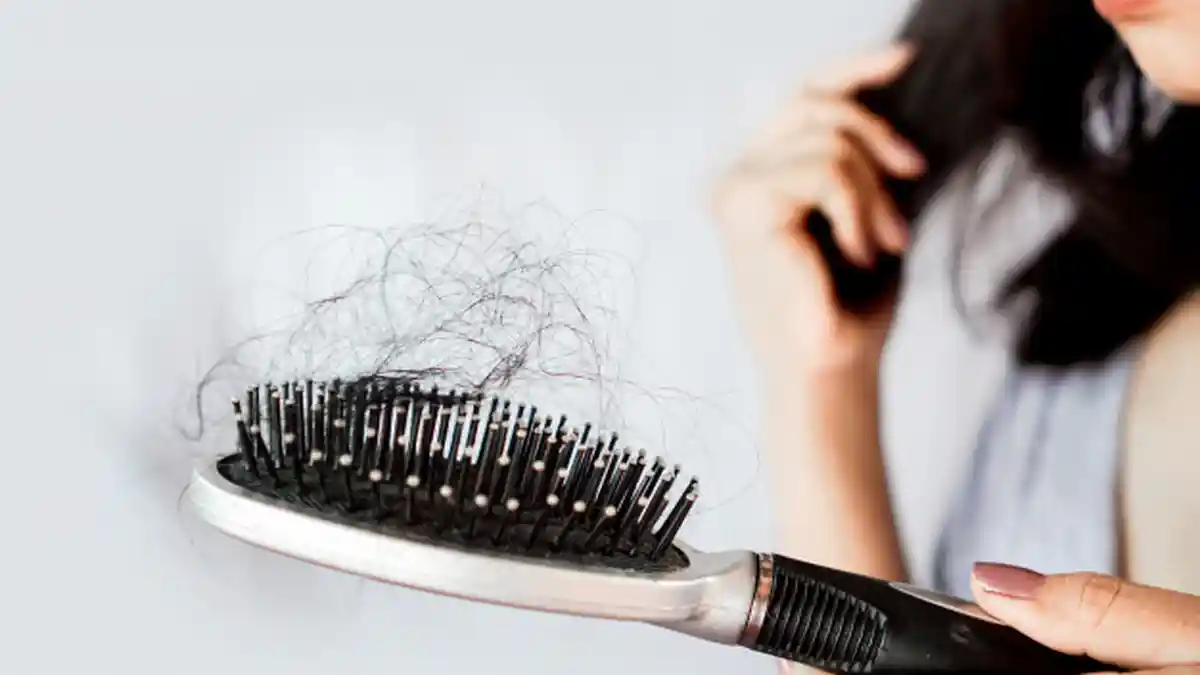 Cara Mengatasi Rambut Rontok dengan Mudah dan Efektif, Salah Satunya Konsumsi Makanan Ini
