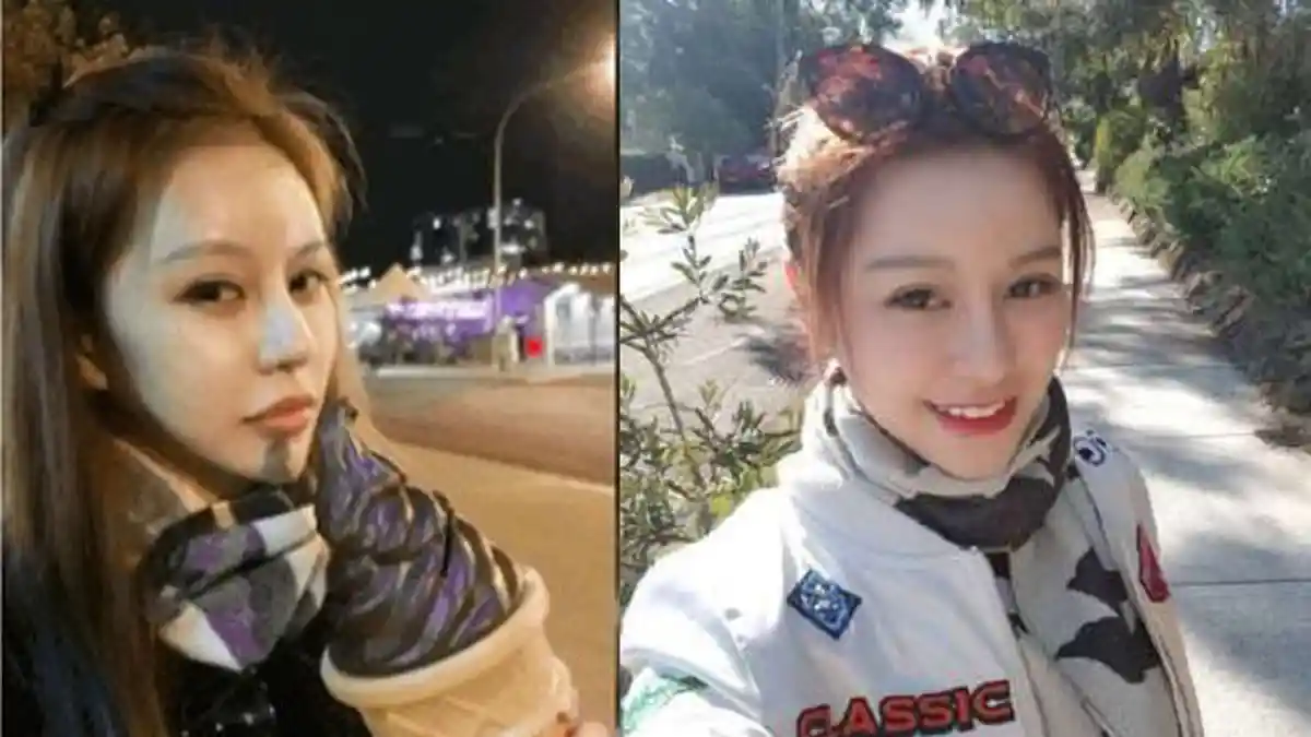 Nuruti Omongan Pacar, Wanita Cantik Lakukan Operasi. Malah Jadi Begini