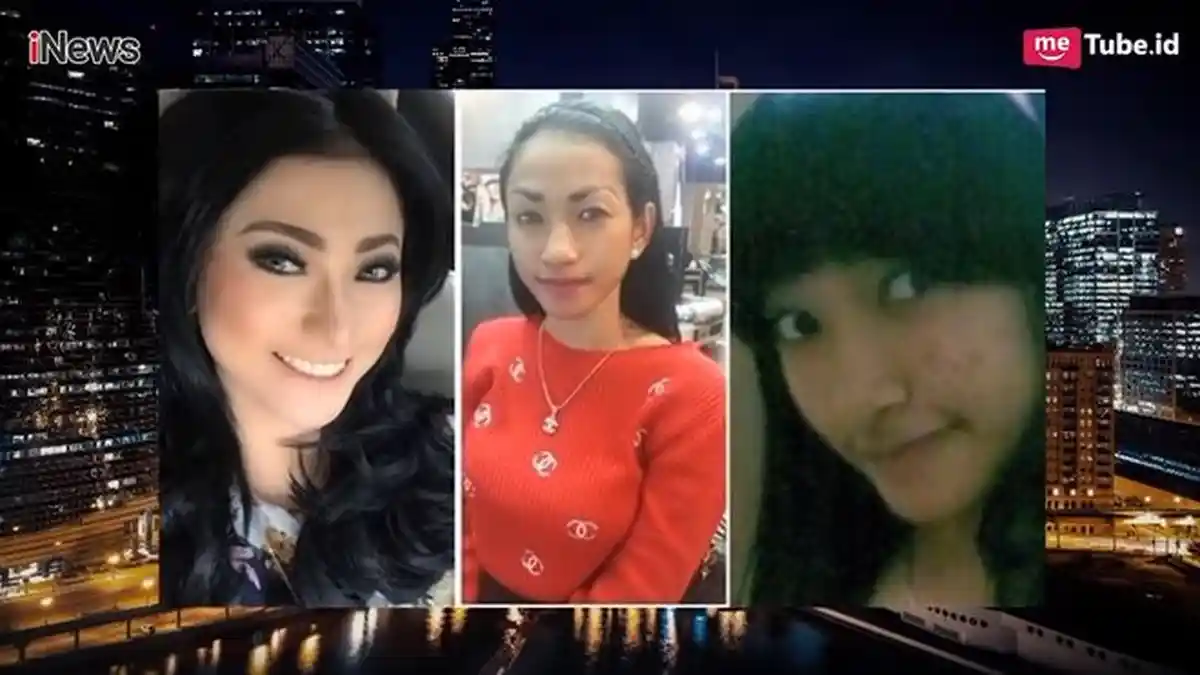 Segini Biaya Operasi dan Perawatan Wajah Amel Alvi, Wajahnya Kini Berubah Drastis