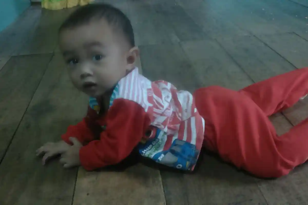 Dana Tak Kunjung Ada, Operasi Alamsyah Bayi Kembar Penderita Jantung Bocor Harus Terkendala