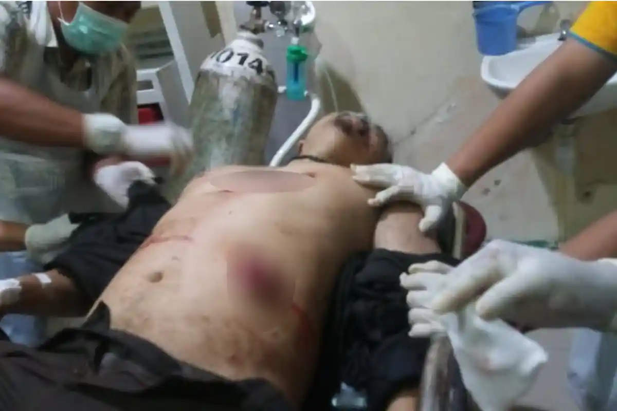 Kena Tikam Orang Tak Dikenal, Warga Jl Khatulistiwa Siantan Ini Luka Parah