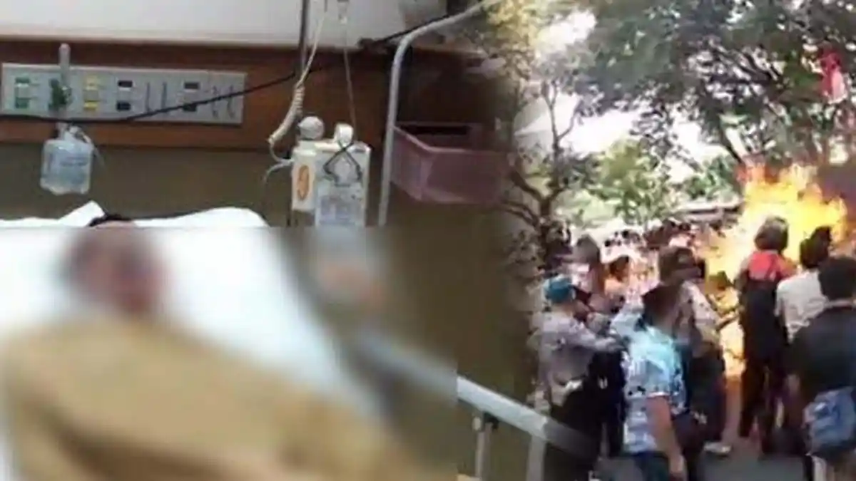 Kondisi Dua Polisi Terbakar di Cianjur Membaik, Briptu Yudi Muslim Sudah Dioperasi di RSHS Hari Ini