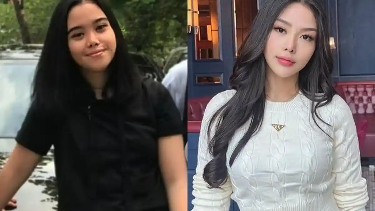 Terkuak Wajah Asli Cindy Rizap Sebelum Oplas , Sosok yang Disebut ...