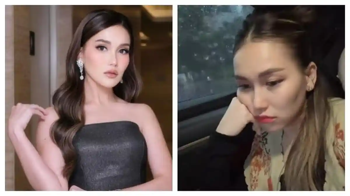 Transformasi Wajah Ayu Ting Ting, Dari Tudingan Oplas Hingga Pengakuan Kalau Pakai Behel