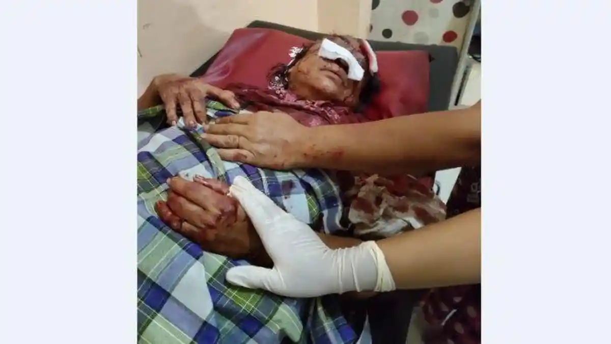 Wanita 65 Tahun Kritis Dianiaya Anak Angkat di Deli Serdang, Pelaku Ditangkap Polisi