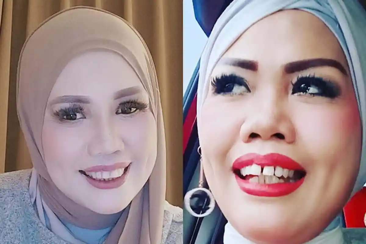 Transformasi Elly Sugigi setelah Potong Gigi, Makin PD, Mengaku Tak Mau Direndahkan Orang Lain