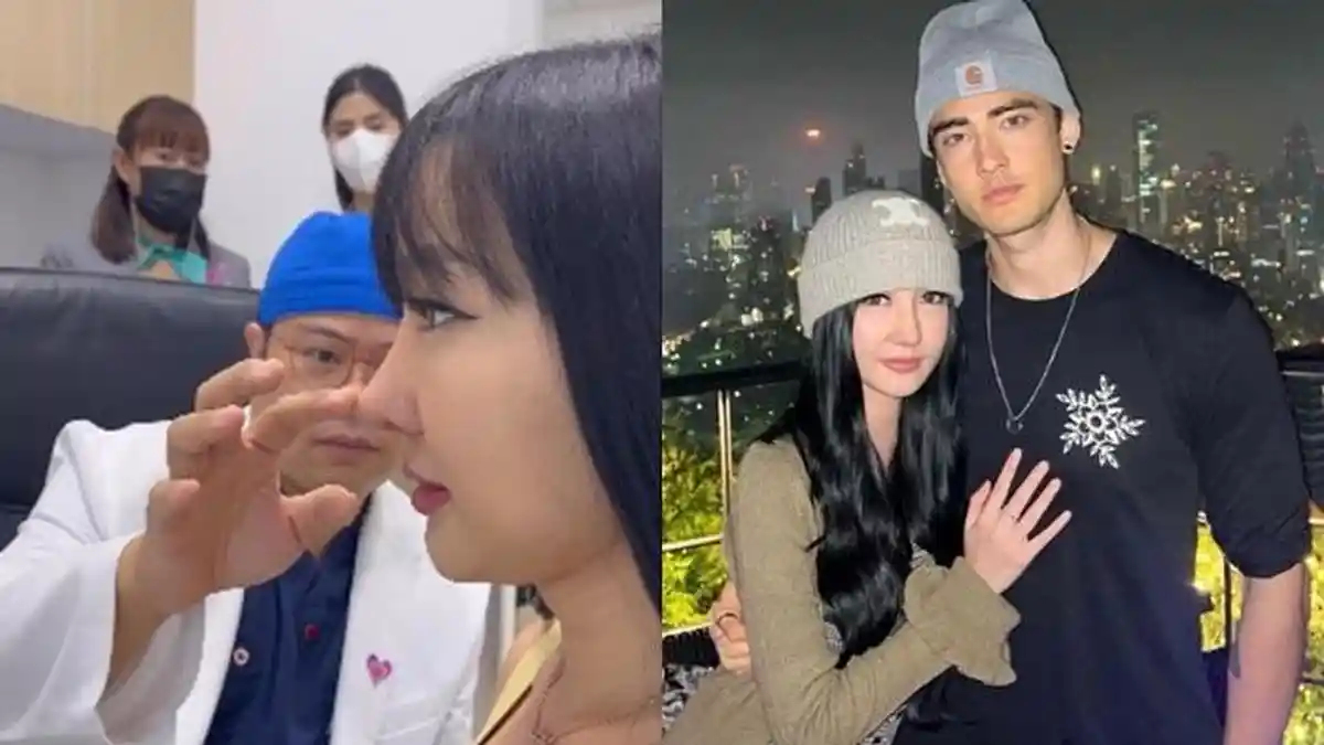 Dihujat Seperti Hidung Pinokoi Begini Wujud Baru Lucinta Luna Pasca ...