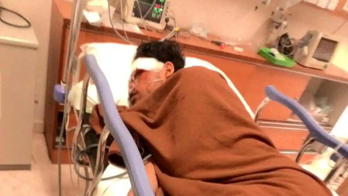 Jimi Ditabrak dan Ditinggalkan Dalam Kondisi Luka Parah