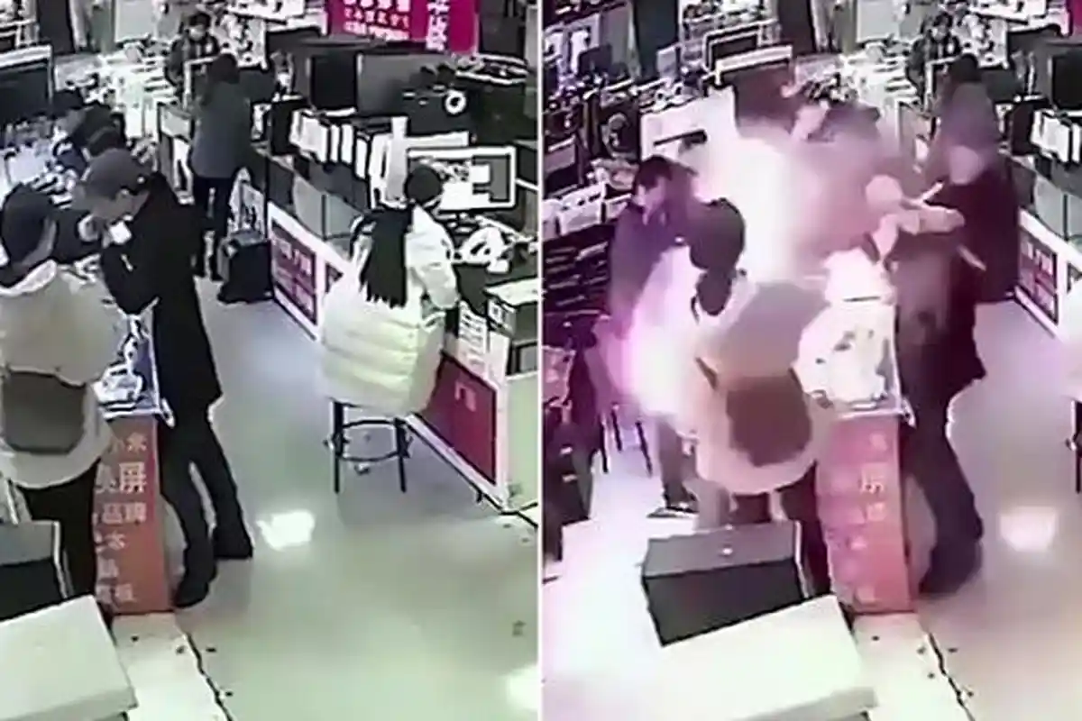 Astaga! Baterai iPhone Meledak di Mulut Seorang Pria saat Ia Berusaha Memerika Keasliannya