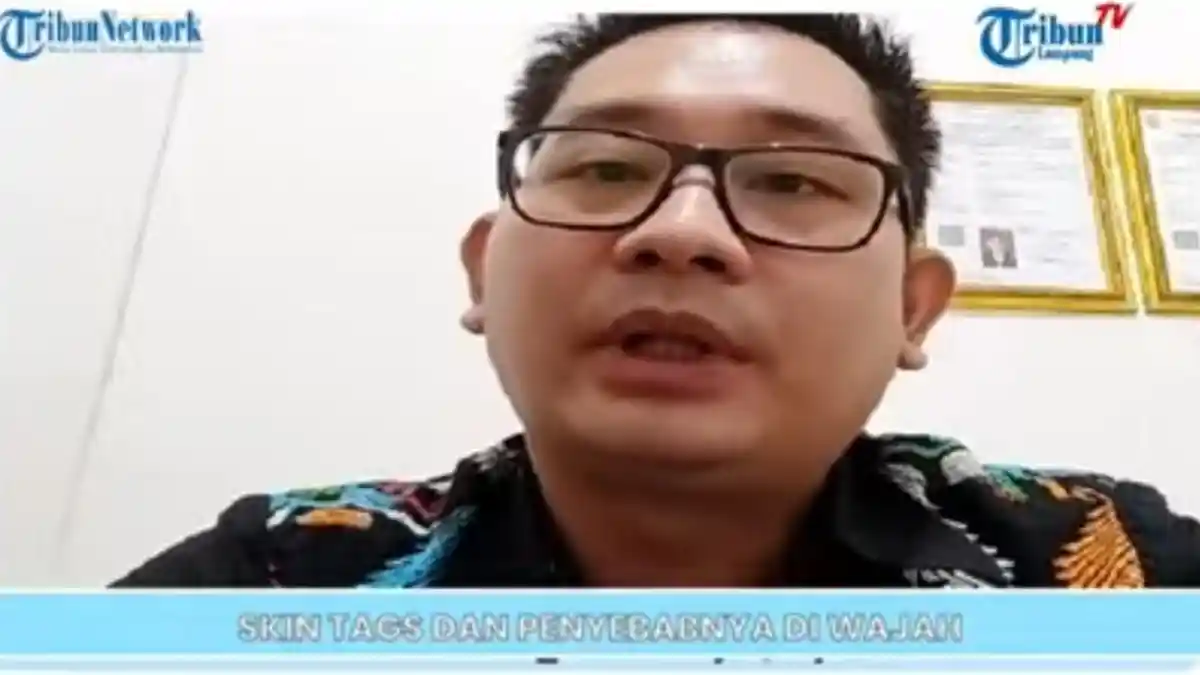 Meski Tak Berbahaya, Skin Tag pada Kulit Menimbulkan Rasa Risih dan Tampak Tidak Menarik