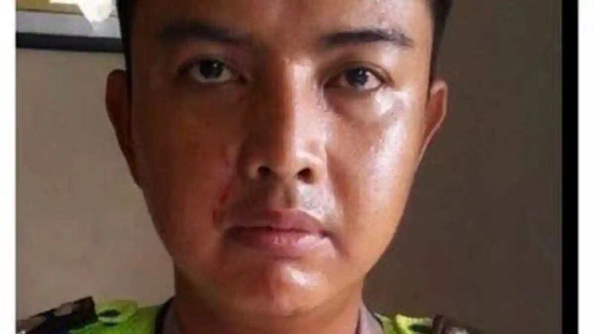 Foto Rustam, Polantas yang Wajahnya Dicakar oleh Seorang Ibu yang Menolak Ditilang