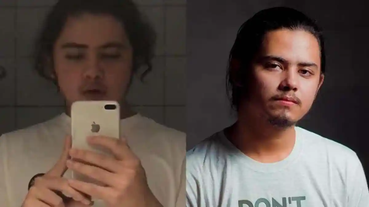 Idap Gangguan Mental OCD, Aliando Syarif Kesulitan Mandi dan Jalan, Psikiater: Harus Terapi Perilaku