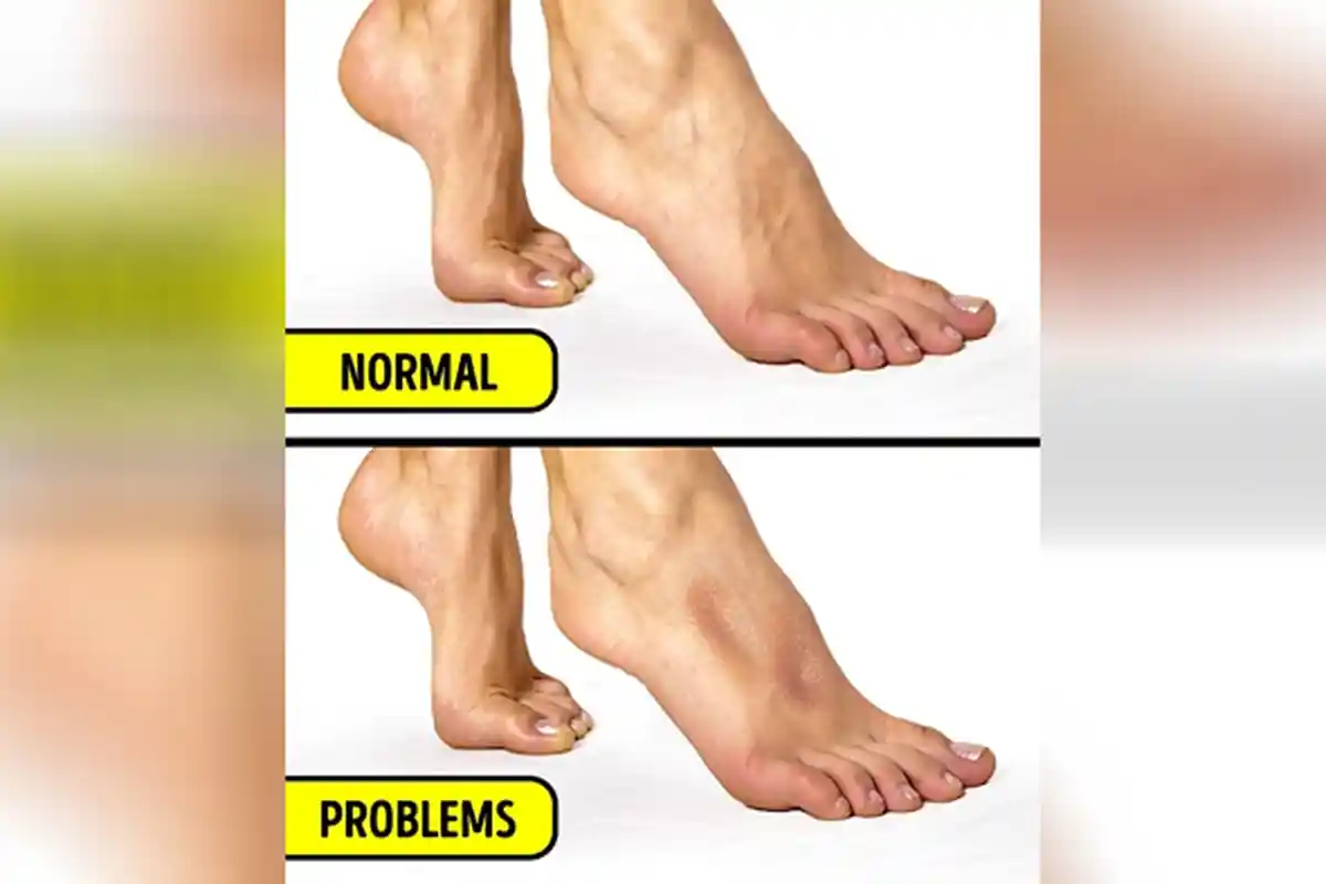 Nggak Perlu ke Dokter, Lewat 5 Hal Sederhana Ini Ternyata Bisa Tunjukkan Kesehatanmu