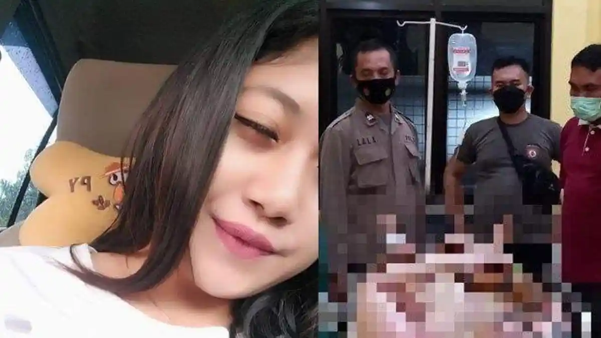 Kesetanan, Pria Ini Nekat Bakar Sang Pacar Hidup-hidup, Wajahnya Luka Bakar Parah