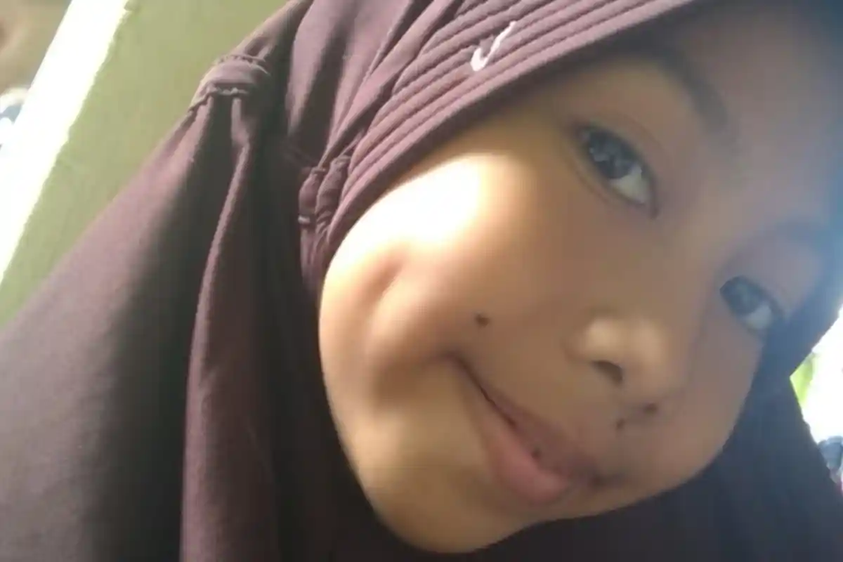 Inilah Rahasia Mitos 81 Letak Tahi Lalat di Seluruh Tubuh: Bibir Atas Kanan = Banyak rezeki, Pandai