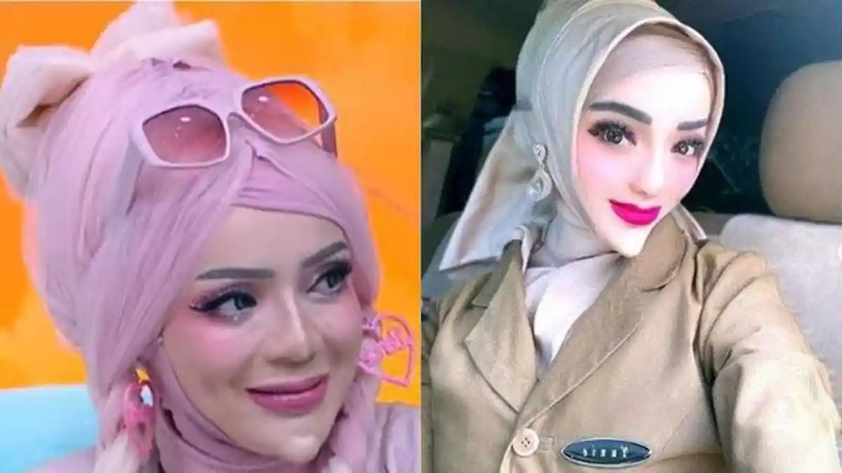 Wajah Asli Yuni PNS Viral karena Berdagu Lancip Terekspos, Jujur Tak Suka Tampil Natural: Buat Apa