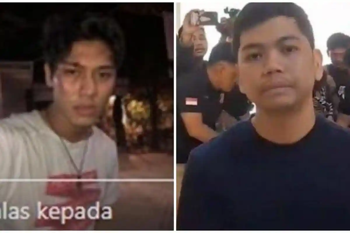 Rizky Billar Ungkap Pernah Dikeroyok Yudha Arfandi, Suami Lesti Kejora Alami Luka-luka di Wajah