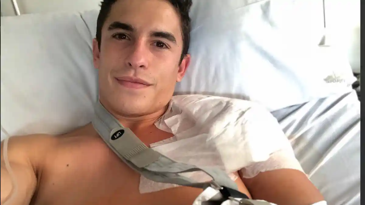 Marc Marquez Terbaring dengan Bahu Sebelah Kiri Diperban, Ini Ungkapan Perasaannya
