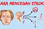 Lakukan Hal Ini untuk Mencegah Stroke, Tips Mudah dr Saddam Ismail