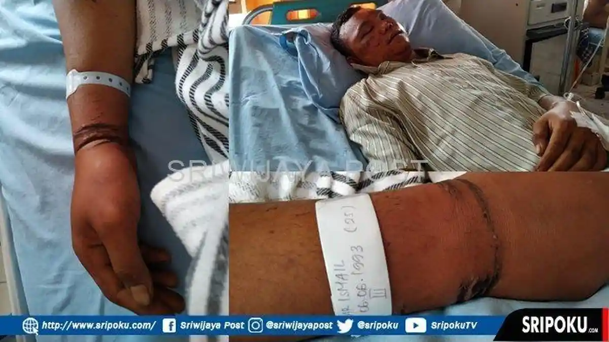 Dipaksa Ngaku Perkosa Bidan Desa, Harismail Babak Belur Dipukuli, Labfor: Tak Ada Bukti Diperkosa