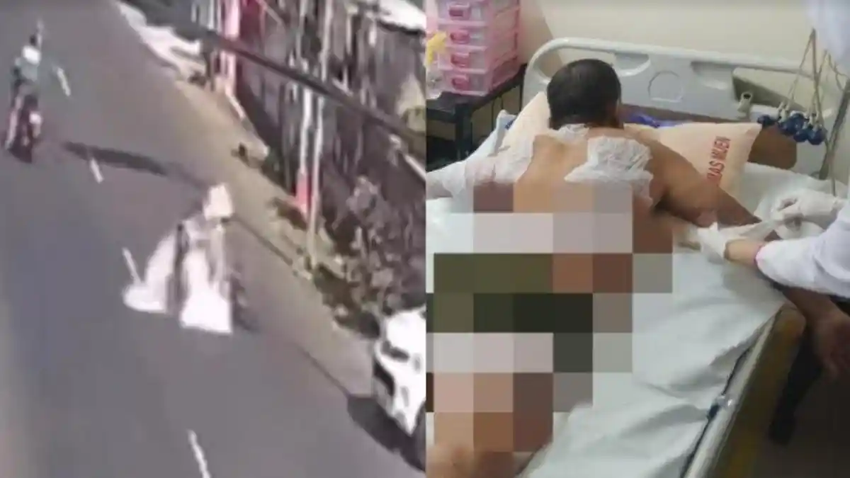 Lawan Arah, Pengendara Motor Tabrak Tukang Bakso hingga Terjatuh dan Tersiram Air Panas