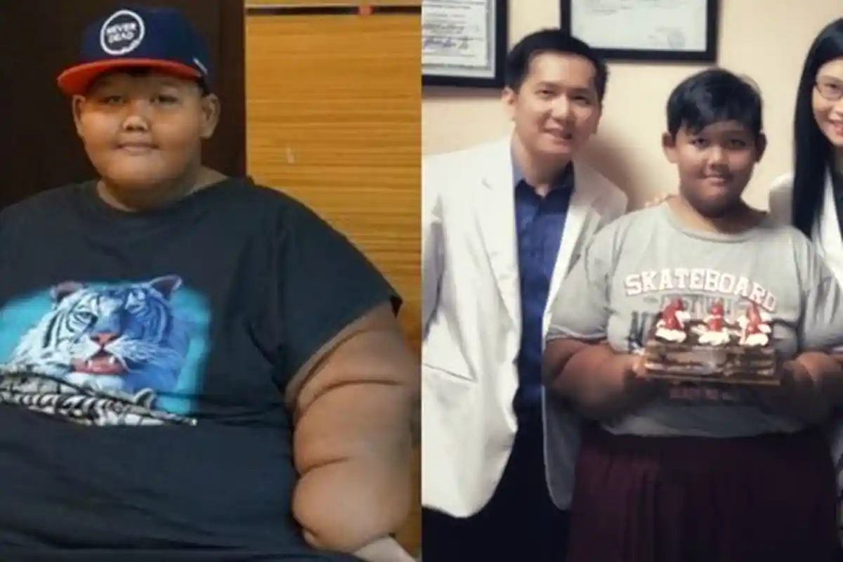 Dulu Beratnya 193 Kg,Aria Sukses Hilangkan Lemak 70 Kg. Begini Hasilnya!