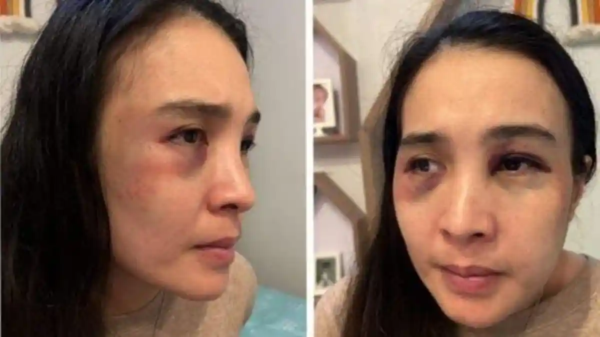 KASUS KDRT Suami Istri Tersangka, Suami Bebas, Istri Ditahan, Akhirnya Mahfud MD Turun Tangan