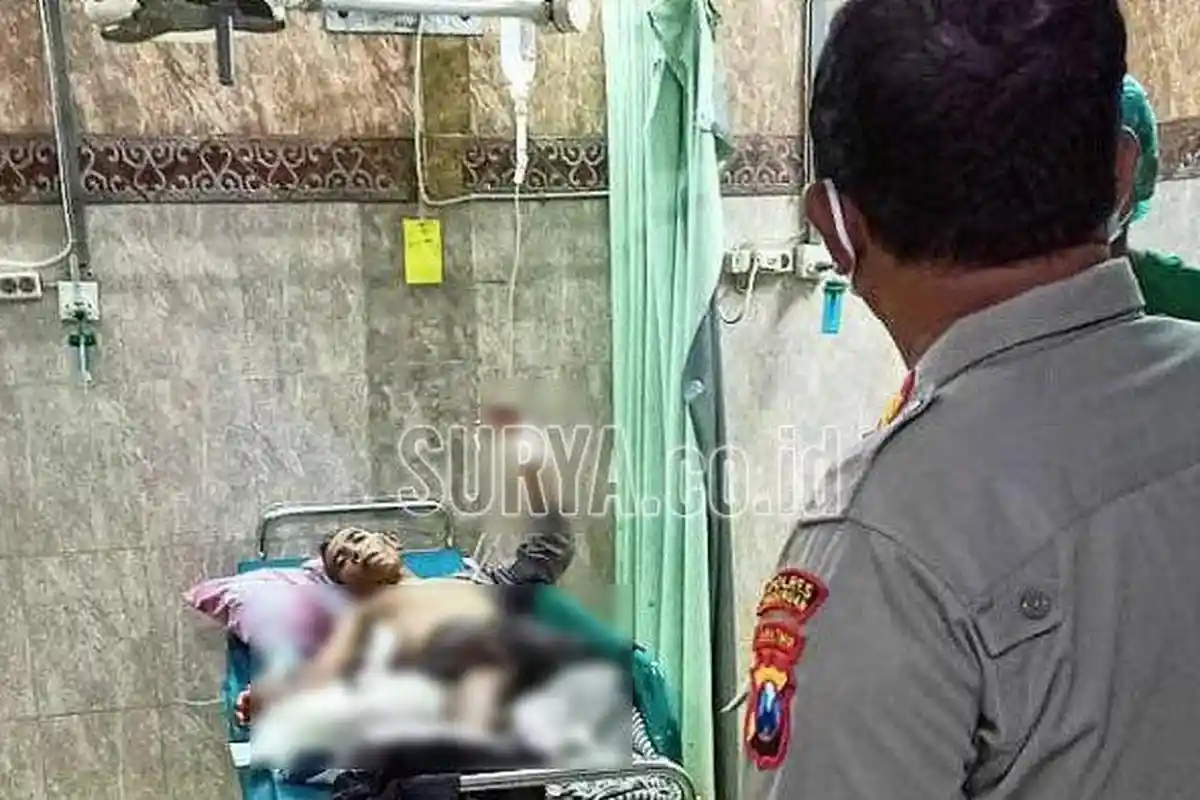 Diduga karena Dendam Asmara, Perempuan di Pasuruan Dihujani 6 Bom Ikan, Malah Kakaknya yang Terluka