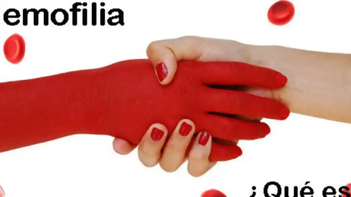 APA Itu Penyakit Hemofilia? Simak Gejalanya pada Anak-anak