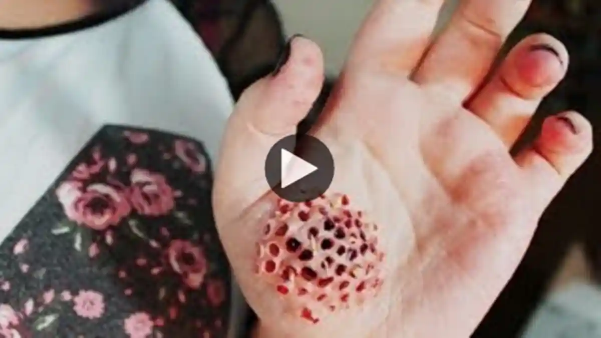 Uji Keberanian Lihat Gambar Berikut Ini, Kalau Gagal Berarti Anda Pengidap Trypophobia