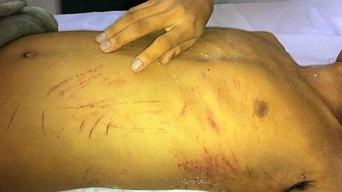 Waduh, Oknum Polisi Pemberantas Narkoba Ini Malah Tewas Diduga OD di Hotel Bersama PSK