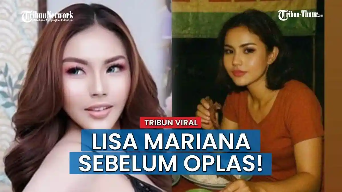 Lisa Mariana Ternyata Pernah Operasi Plastik, Ini Potret Wajah Aslinya, Sadar Diri Hidungnya Pesek