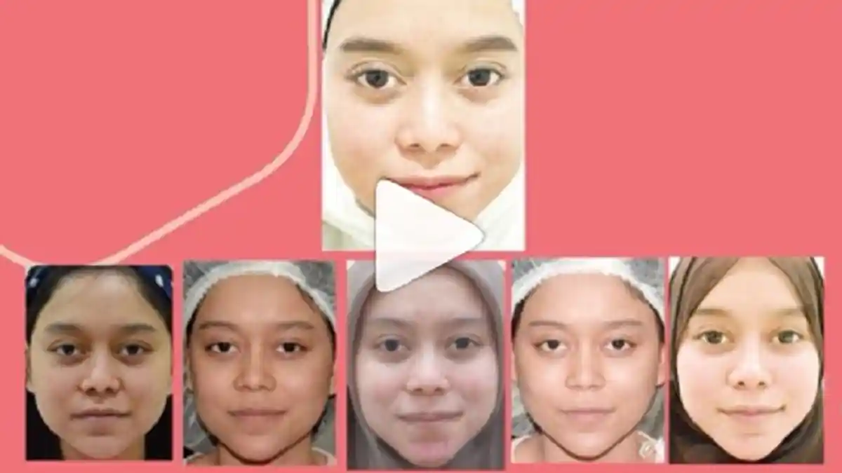 Ternyata Ini Bagian Wajah Lesti Kejora yang Dibotox Dan Tanam Benang