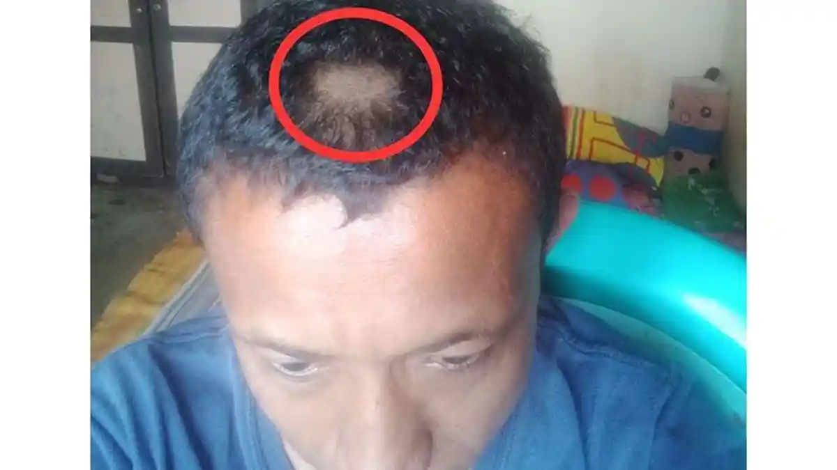 Orang Tua Murid Balas Dendam Potong Paksa Rambut Pak Guru hingga Tampak Kulit Kepala