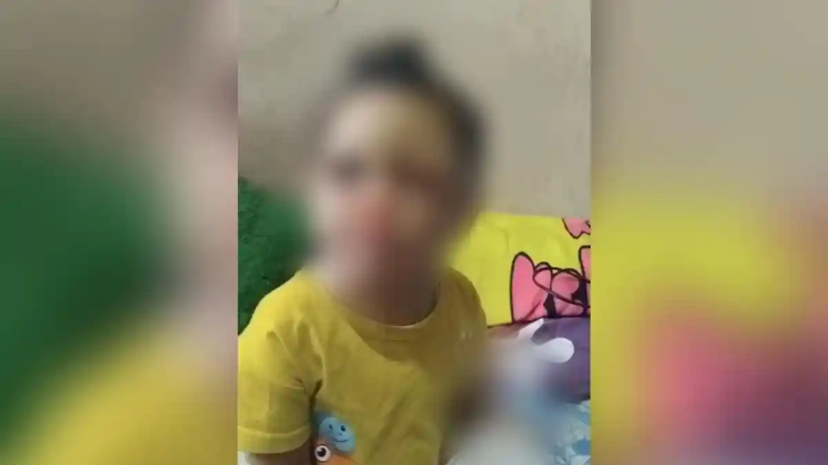 Apa Itu Osteogenesis Imperfecta, Penyakit Langka yang Diduga Diidap Balita SA Garut: Matanya Biru