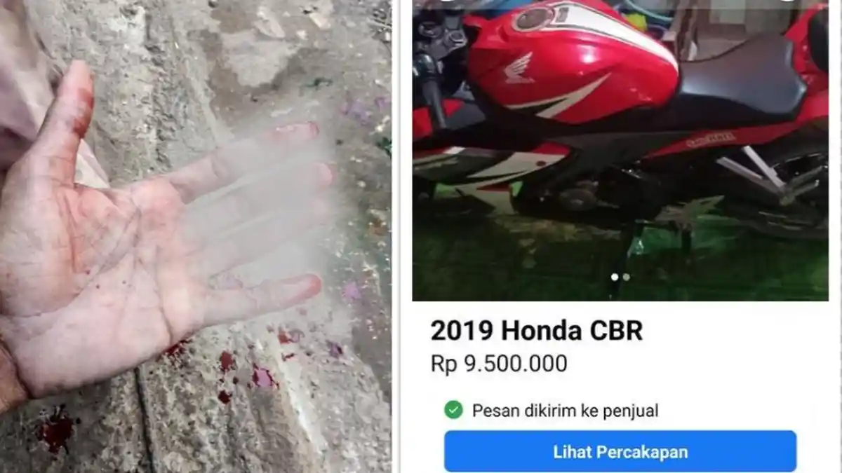 Niat Beli Motor Murah dengan COD, Pria Ini Malah Luka Robek di Tangan