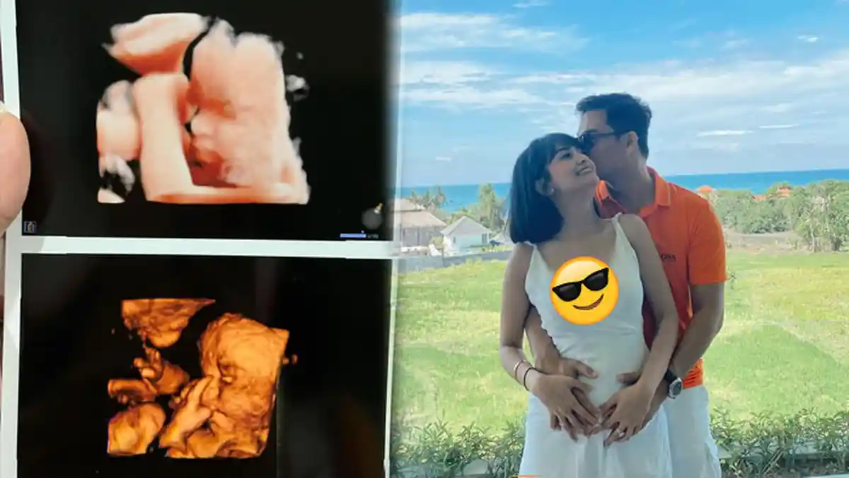 Pamer Hasil USG, Potret Calon Buah Hati Vanessa Angel Curi Perhatian, Bibi Ardiansyah: Mancung