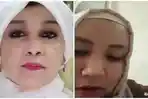 IDI Sumsel Sesalkan Ulah Dokter Tamara yang Viral Hina Pasien BPJS, Terancam Kena Sanksi Etik