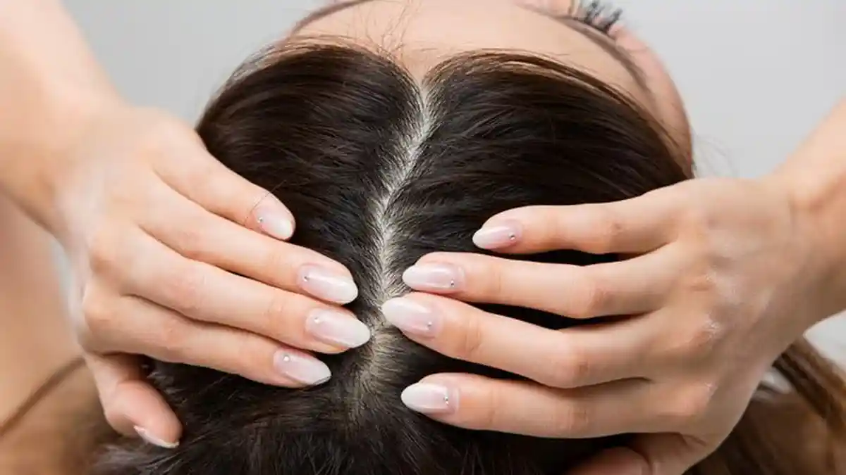 Mengurangi Rambut Rontok dengan Bahan Alami, Gunakan Telur dan Minyak Zaitun Hingga Jus Bawang