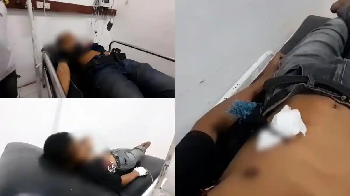 BREAKING NEWS: Waspada! Teror Busur 'Hantui' Warga Makassar, Dua Remaja Jadi Korban di Panakkukang