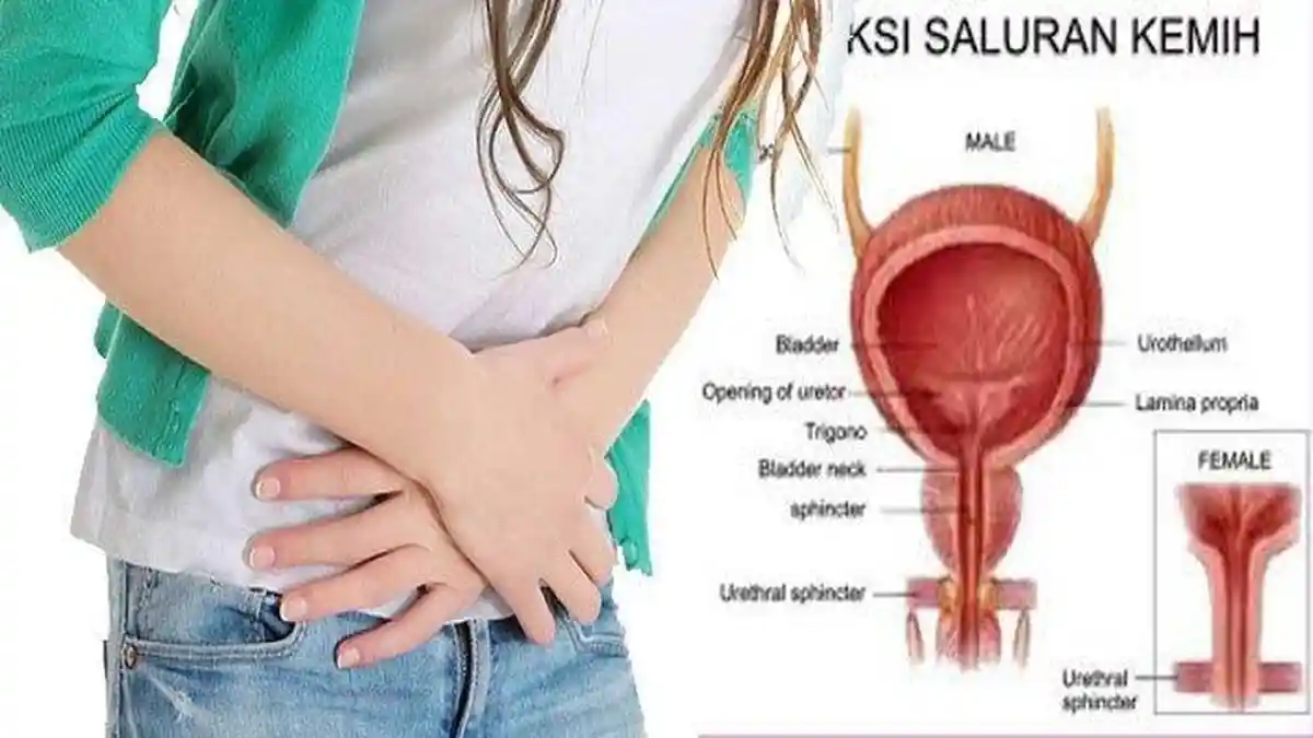 Mengenali Gejala Infeksi Saluran Kemih (ISK) atau Anyang-anyangan dan Cara Mengatasinya