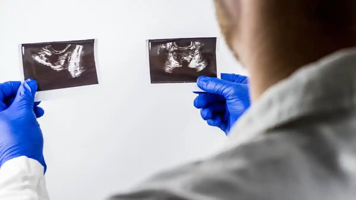 Gejala Kanker Prostat - Nyeri di Pinggul, Darah di Urine, Kesulitan Ereksi
