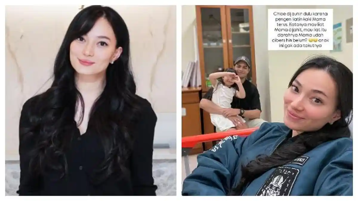 Asmirandah Jatuh di Kamar Mandi, Kaki Robek hingga Terima 8 Jahitan, Jonas Rivanno Panik, Kondisinya