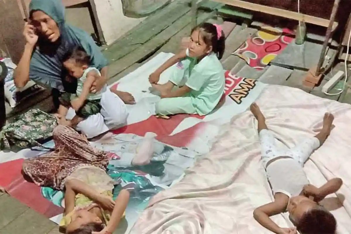 Ayah Siram Anak Tiri dengan Air Panas,  Nuraini Sudah Dua Pekan Tak Bersekolah